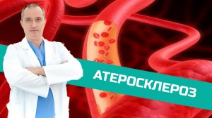 Атеросклероз