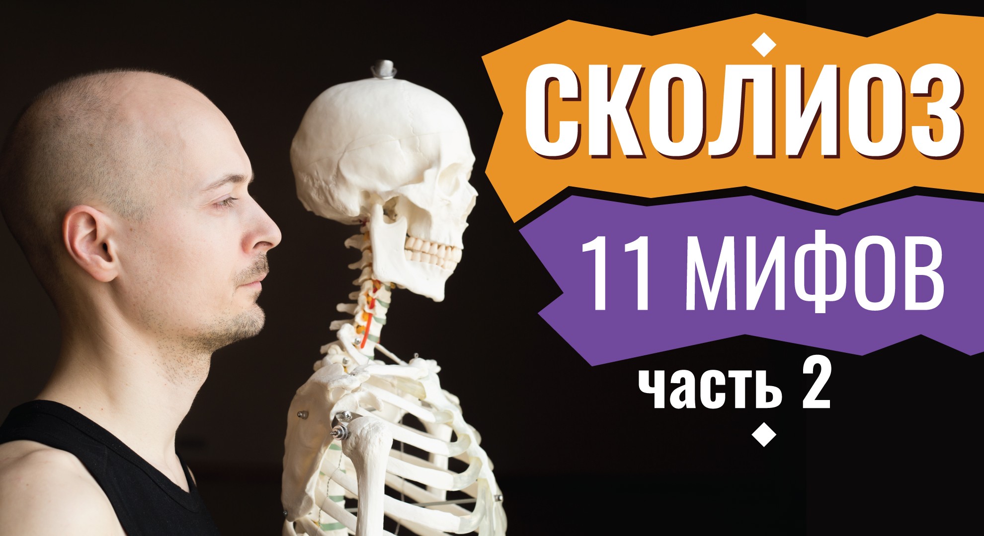 СКОЛИОЗ. МИФЫ И ЗАГАДКИ,
