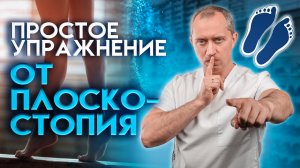 Плоскостопие